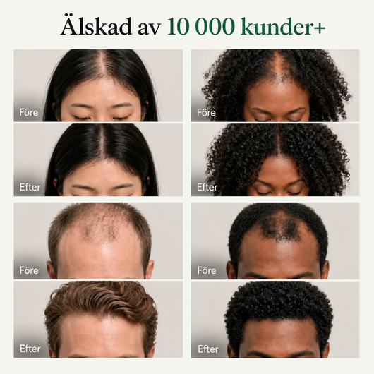 Koreansk Scalp Revival Bar